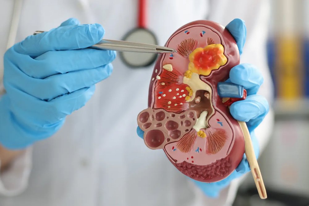 Urology